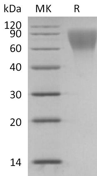 Human CD34 +SDS-PAGE.jpg